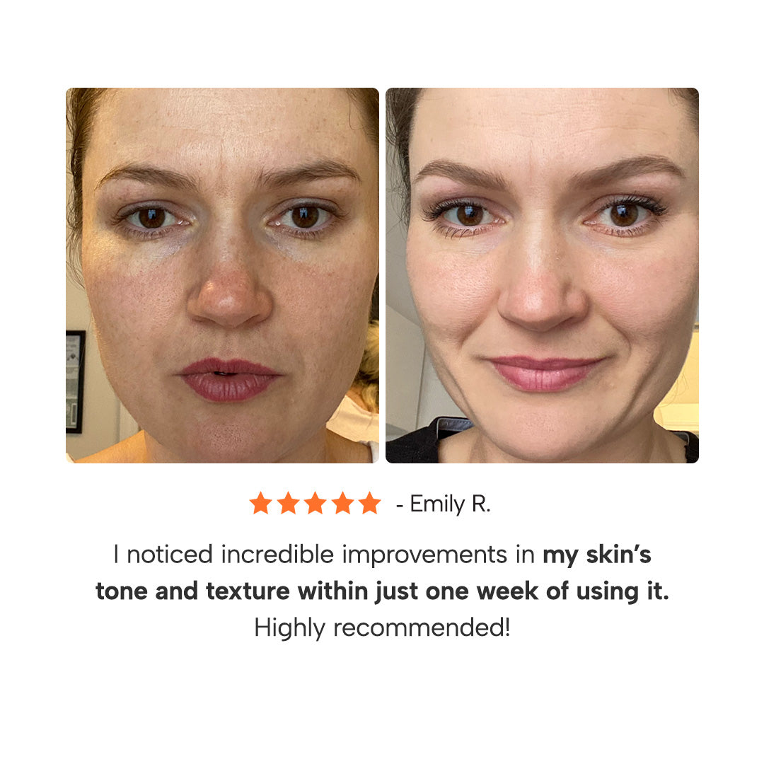 Epify Radiant Glow Face Care Set