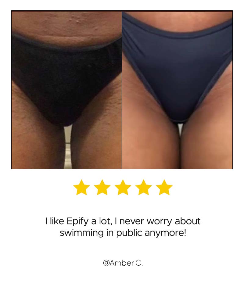 HAIR REMOVAL BUNDLE