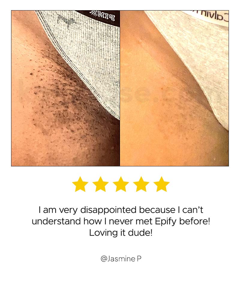 HAIR REMOVAL BUNDLE