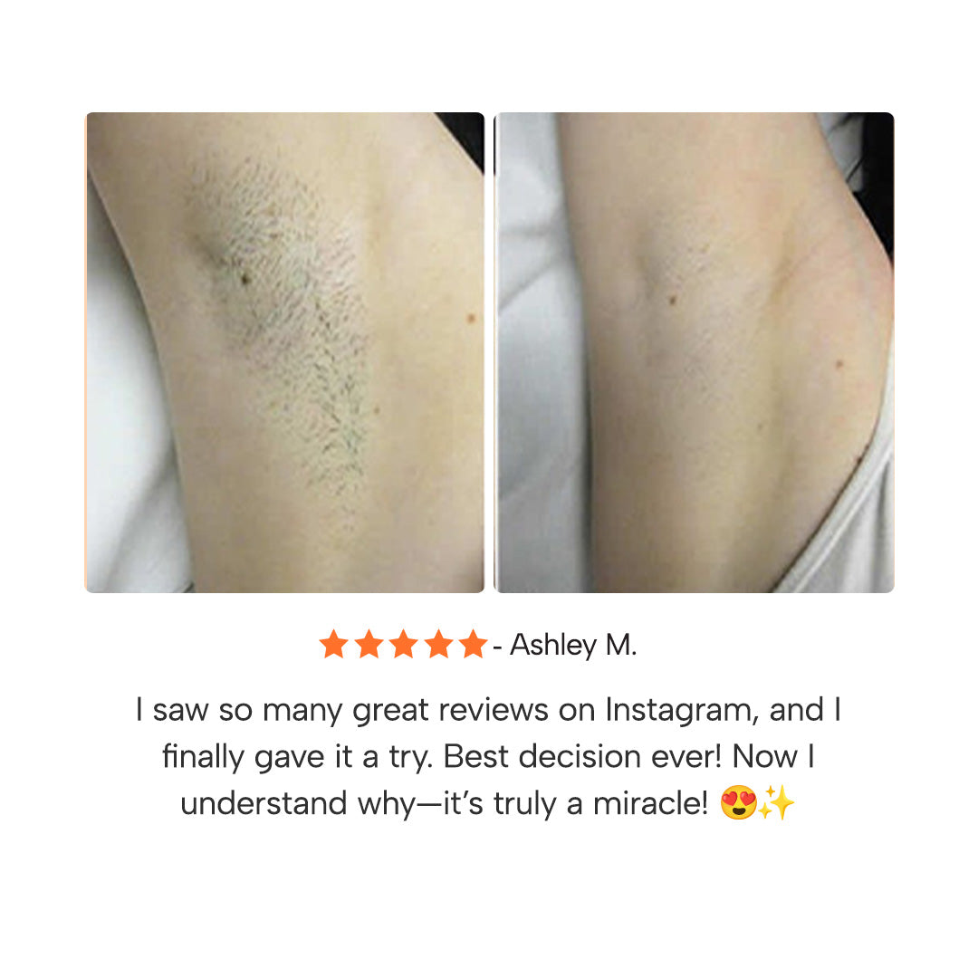 Epify™ Hair Removal Gel Cream