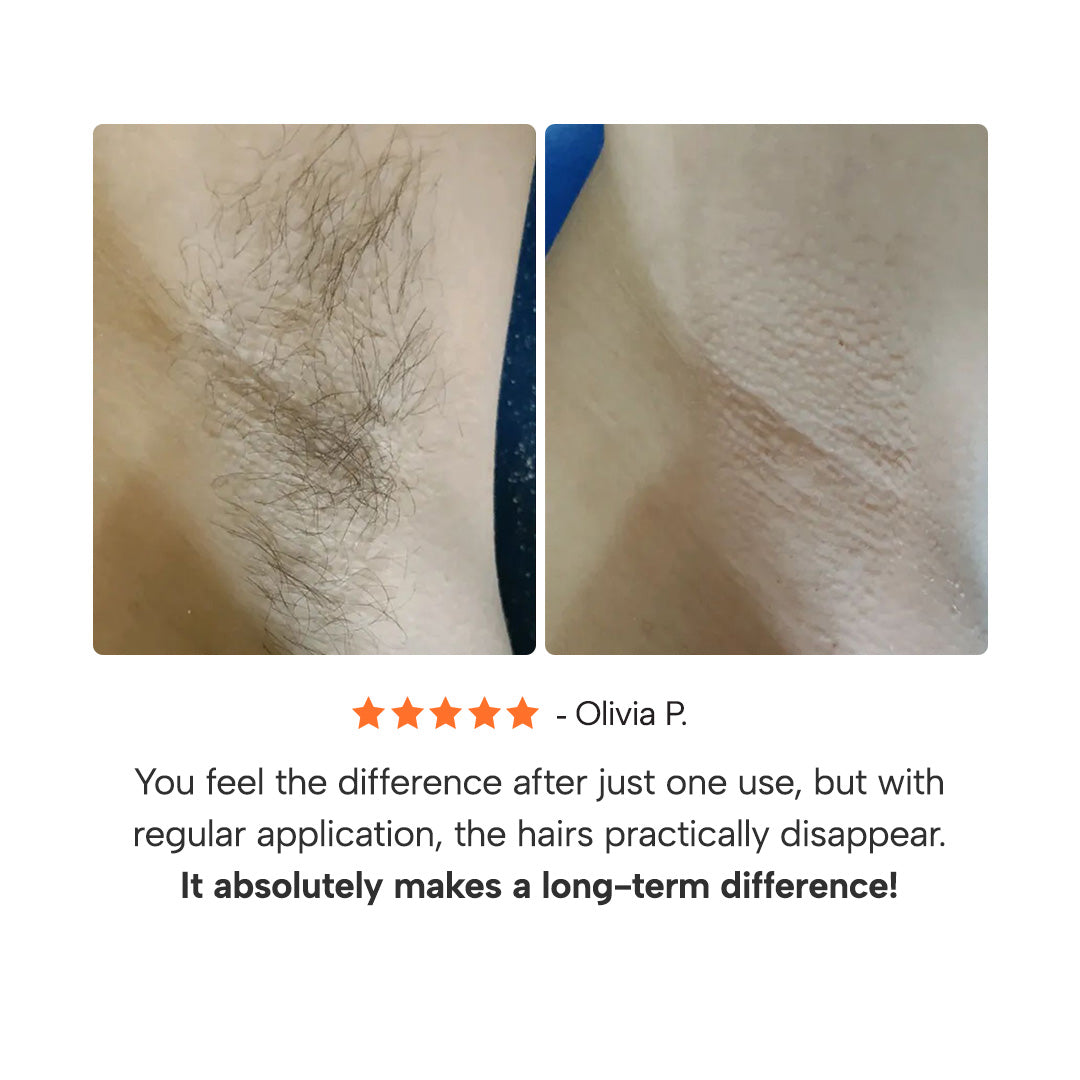 Epify™ 3-in-1 Underarm Roll-On Unisex