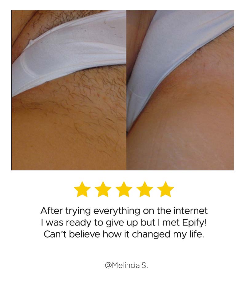 HAIR REMOVAL BUNDLE